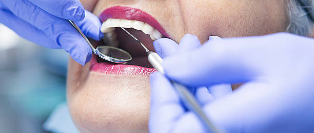 Best Emergency Treatment for Oral Infections in Brownsville, TX